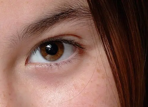 Almond Eyes